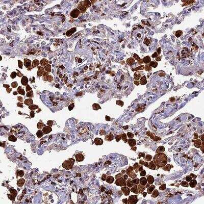 Immunohistochemistry-Paraffin: HIC1 Antibody [NBP1-80607]