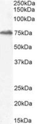 Western Blot: HIC1 Antibody [NBP2-26159]