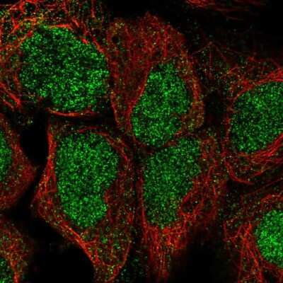 Immunocytochemistry/ Immunofluorescence: HIC2 Antibody [NBP2-55846]