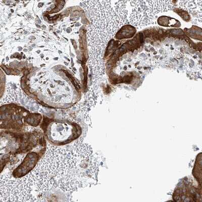 Immunohistochemistry-Paraffin: HIC2 Antibody [NBP1-81710]