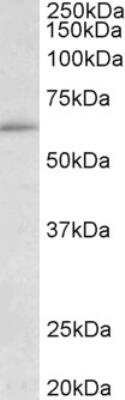 Western Blot: HIC2 Antibody [NBP2-26160]