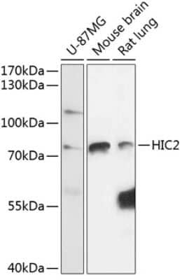 Western Blot: HIC2 AntibodyAzide and BSA Free [NBP3-04516]