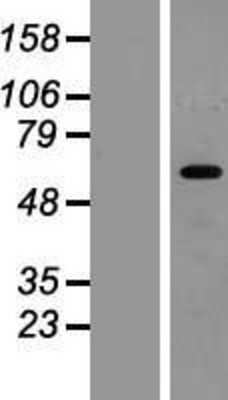 Western Blot: HIC2 Overexpression Lysate [NBP2-07213]