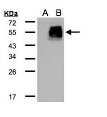 Western Blot: HIC5/TGFB1I1 Antibody [NBP2-16828]