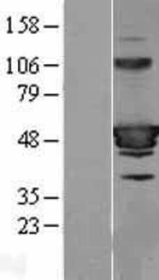 Western Blot: HIC5/TGFB1I1 Overexpression Lysate [NBP2-11481]