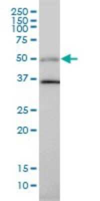 Western Blot: HIC5/TGFB1I1 Antibody (4B2-D8) [H00007041-M01]