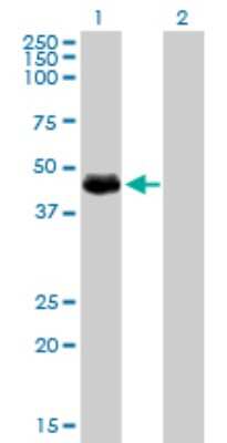 Western Blot: HIC5/TGFB1I1 Antibody (4B2-D8) [H00007041-M01]