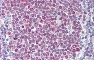 Immunohistochemistry: HIC5/TGFB1I1 Antibody [NBP3-10498]