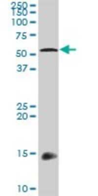 Western Blot: HIC5/TGFB1I1 Antibody [H00007041-D01P]