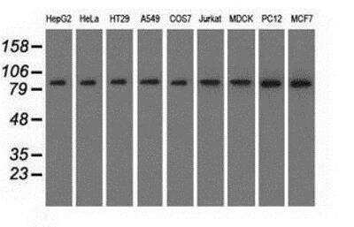 Western Blot: HID1 Antibody (OTI2F4) [NBP2-02667]