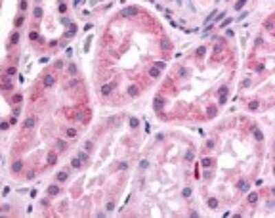 Immunohistochemistry: HIF-1 alpha Antibody - BSA Free [NB100-134]