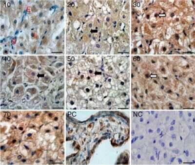 Immunohistochemistry-Paraffin: HIF-1 alpha Antibody - BSA Free [NB100-134]