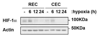 Western Blot: HIF-1 alpha AntibodyBSA Free [NB100-134]