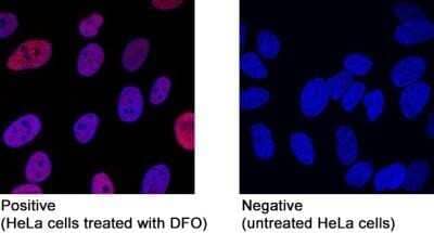 Immunocytochemistry/ Immunofluorescence: HIF-1 alpha Antibody (2443B) - Azide and BSA Free [NBP2-80764]