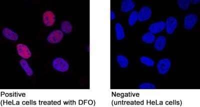 Immunocytochemistry/ Immunofluorescence: HIF-1 alpha Antibody (2443C) - Azide and BSA Free [NBP2-80765]