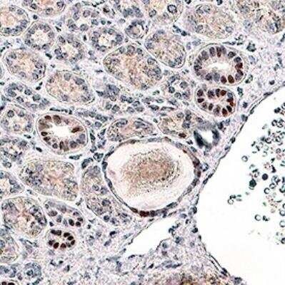 Immunohistochemistry-Paraffin: HIF-1 alpha Antibody (2443C) - BSA Free [NBP2-75978]
