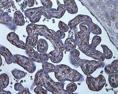 Immunohistochemistry: HIF-1 alpha Antibody (ESEE122) - Azide and BSA Free [NBP2-80762]