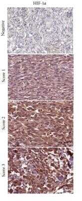 Immunohistochemistry: HIF-1 alpha Antibody (ESEE122) - Azide and BSA Free [NBP2-80762]