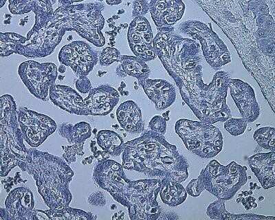 Immunohistochemistry: HIF-1 alpha Antibody (ESEE122) - Azide and BSA Free [NBP2-80762]