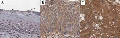 Immunohistochemistry: HIF-1 alpha Antibody (ESEE122) - Azide and BSA Free [NBP2-80762]