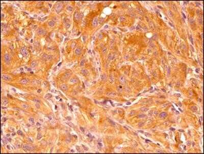 Immunohistochemistry-Paraffin: HIF-1 alpha Antibody (ESEE122) - Azide and BSA Free [NBP2-80762]