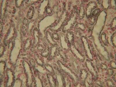 Immunohistochemistry-Paraffin: HIF-1 alpha Antibody (ESEE122) - Azide and BSA Free [NBP2-80762]