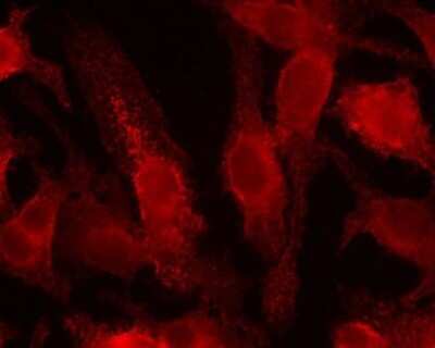 Immunocytochemistry/ Immunofluorescence: HIF-1 alpha Antibody (ESEE122) [NB100-131]