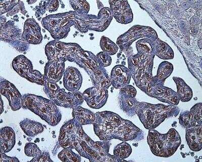 Immunohistochemistry: HIF-1 alpha Antibody (ESEE122) [NB100-131]