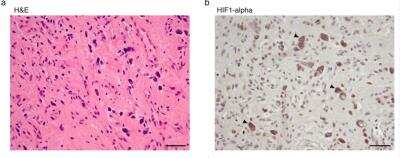 Immunohistochemistry: HIF-1 alpha Antibody (ESEE122) [NB100-131]