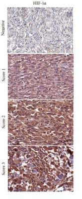 Immunohistochemistry: HIF-1 alpha Antibody (ESEE122) [NB100-131]