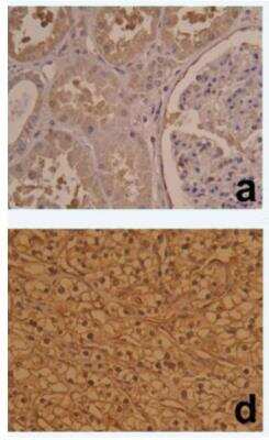 Immunohistochemistry: HIF-1 alpha Antibody (ESEE122) [NB100-131]