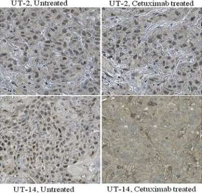 Immunohistochemistry: HIF-1 alpha Antibody (ESEE122) [NB100-131]