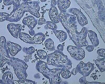 Immunohistochemistry-Paraffin: HIF-1 alpha Antibody (ESEE122) [NB100-131]