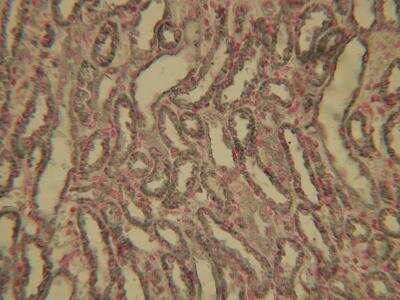 Immunohistochemistry-Paraffin: HIF-1 alpha Antibody (ESEE122) [NB100-131]