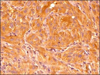 Immunohistochemistry-Paraffin: HIF-1 alpha Antibody (ESEE122) [NB100-131]
