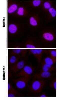 Staining of HIF-1 alpha in DFOA Treated and non-Treated HeLa Cells