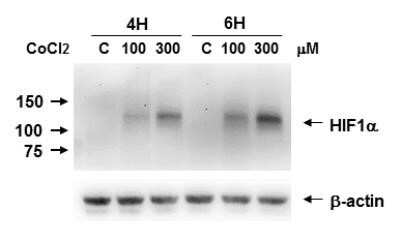 Western Blot Analysis of HIF-1 alpha in Caki-1 Cell Lysates
