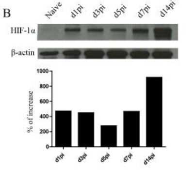 Western Blot of HIF-1 alpha in CD11c+ Cells from C57BL/6 Mice and Densitometric Analysis