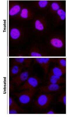 Staining of HIF-1 alpha in DFOA Treated and non-Treated HeLa Cells