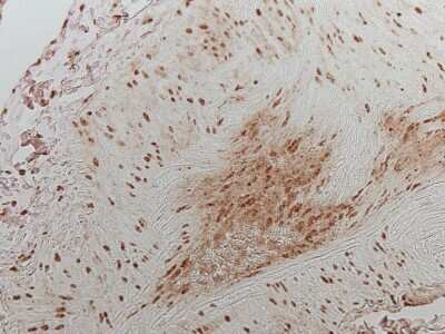Immunohistochemistry: HIF-1 alpha Antibody (H1alpha67) [NB100-123]