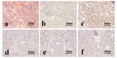 Immunohistochemistry: HIF-1 alpha Antibody (H1alpha67) [NB100-123]