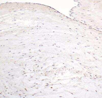 Immunohistochemistry-Paraffin: HIF-1 alpha Antibody (H1alpha67) [NB100-123]