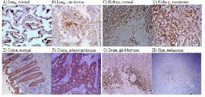 Immunohistochemistry-Paraffin: HIF-1 alpha Antibody (H1alpha67) [NB100-123]