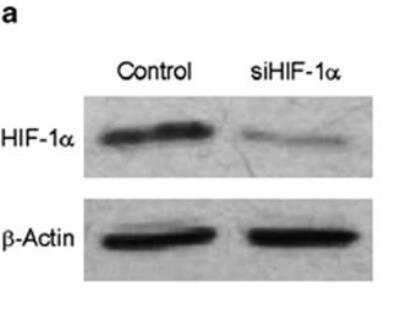 Knockdown Validated: HIF-1 alpha Antibody (H1alpha67) [NB100-123]