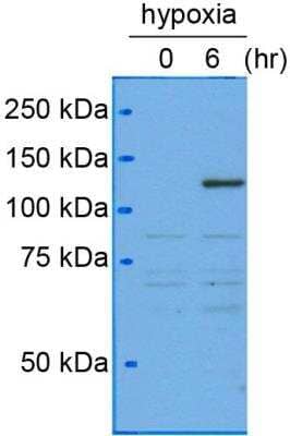 Western Blot Analysis of HIF-1 alpha in Human Hepatocytes