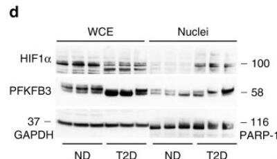 Western Blot Analysis of HIF-1 alpha in Nuclear-Enriched and Whole Cell Extracts from Non-Diabetic and T2D Donor Islets