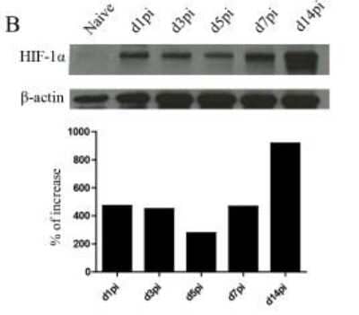 Western Blot of HIF-1 alpha in CD11c+ Cells from C57BL/6 Mice and Densitometric Analysis