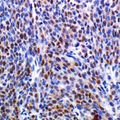 Immunohistochemistry-Paraffin: HIF-1 alpha Antibody (HA111) - BSA Free [NB100-296]