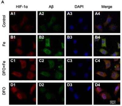 Immunofluorescence Labeling and Confocal Microscopy Analysis of the Distribution of HIF-1 alpha and Abeta in APPsw Cells