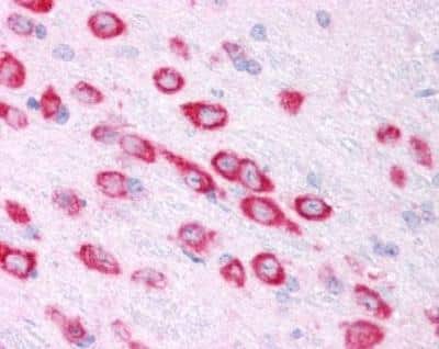 Immunohistochemistry: HIF-1 alpha Antibody [NB100-449]